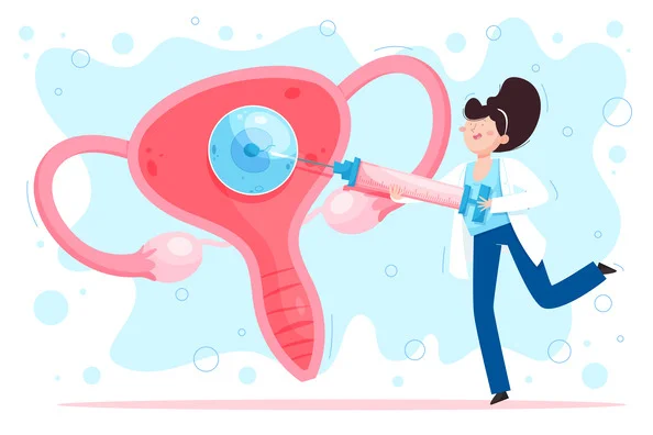 IUI Treatment Procedure