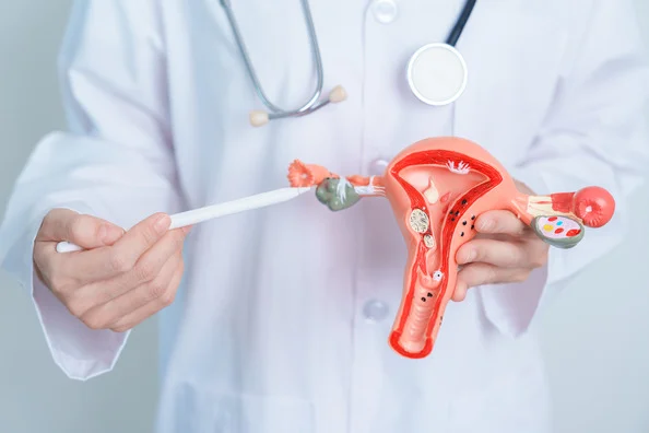 Fibroids: Causes, Symptoms, and Treatment Options
