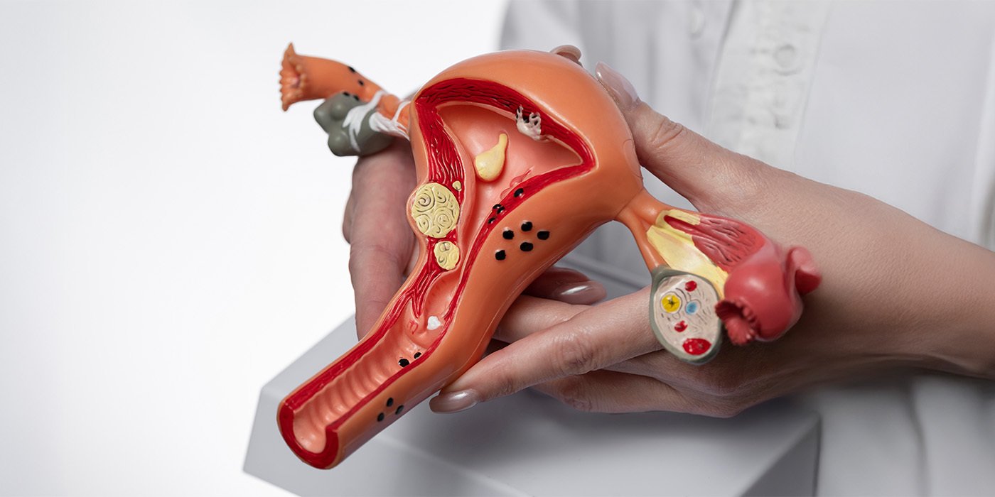 iui treatment in hindi